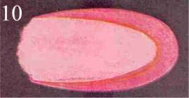 Figure 10 – Affection bien définie