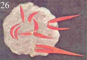 Figure 26 – Jalousie inquiète et colère