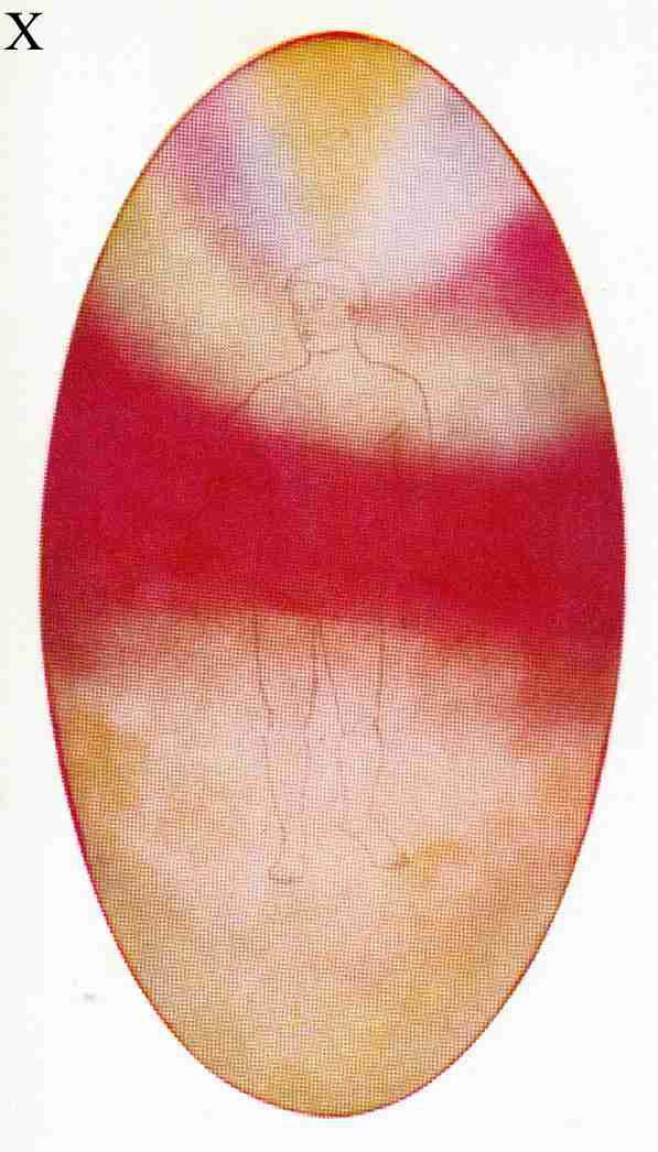Figure 10 – Corps astral d'un homme ordinaire