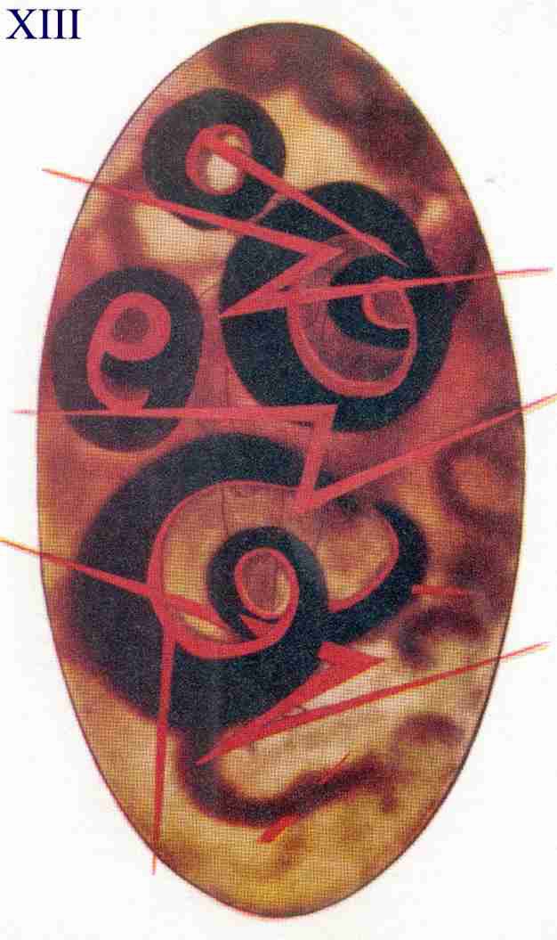 Figure 13 – Colère intense avec pensées de méchanceté et malveillance